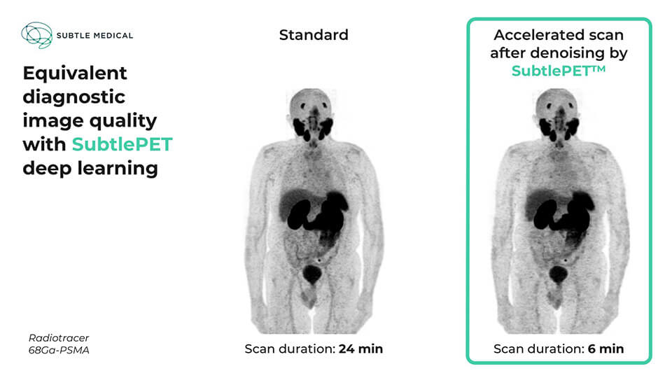 SubtlePET 2.0 Gets CE Mark • APPLIED RADIOLOGY