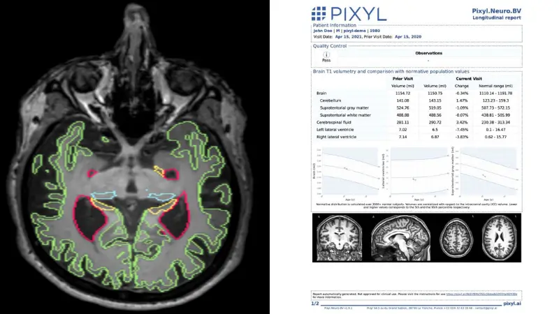 Pixyl.Neuro.BV