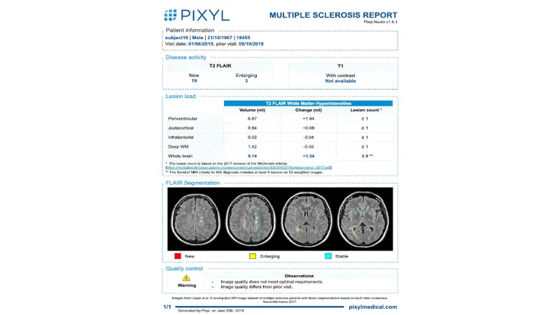 Pixyl.Neuro.MS