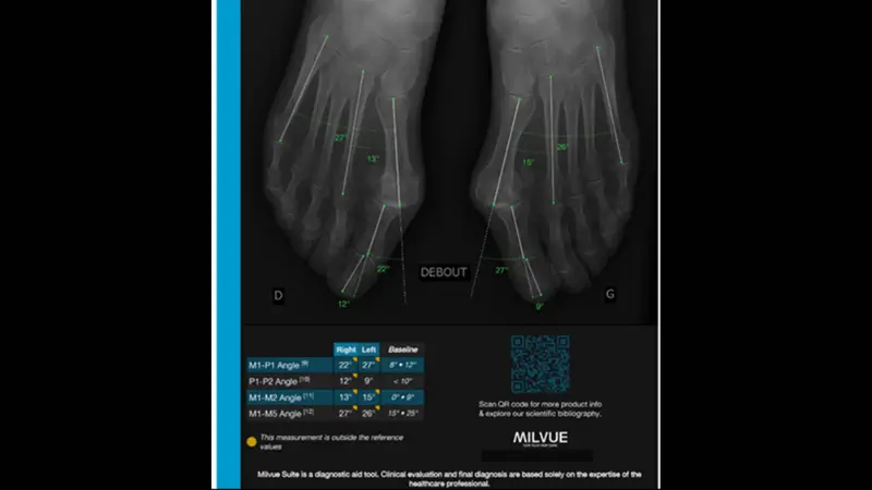 TechCare Bones™