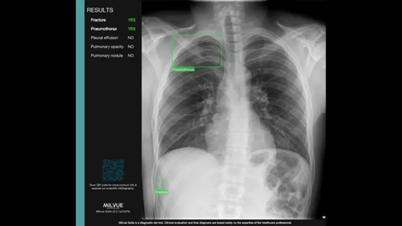 TechCare Chest™