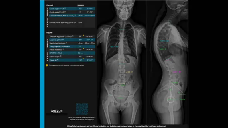 TechCare Spine™