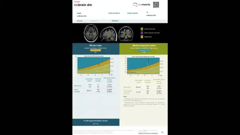 icobrain dm CE icobrain dm CE