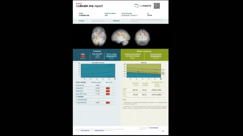 icobrain ms CE icobrain ms CE