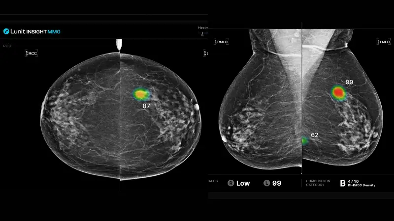 Lunit INSIGHT Breast Suite (MMG and DBT) CE and FDA